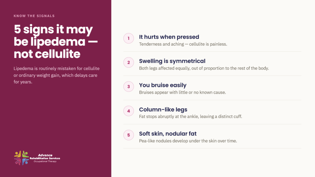 signs-it-may-be-lipedema