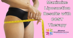 How a Certified Cosmetic Surgery Therapist Can Improve Liposuction Outcomes