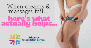 If Cellulite Reduction Doesn't Work For You, You Might Have Lipedema