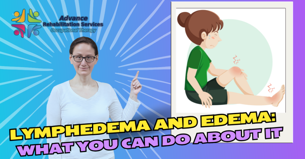 I Have Edema What It Means and How to Manage It Blog Thumb